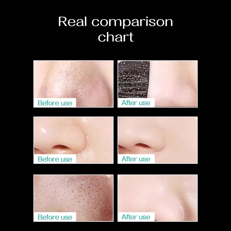 60g Blackhead Removing Nasal Mask Mild And Non Irritating To Shrink Pores And Remove Blackhead And Acne Tearing Facial Mask