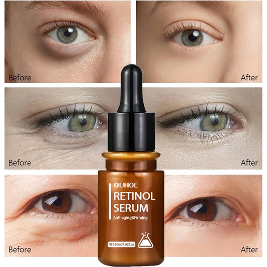 Retinol Eye Serum Dark Circle Eye Bags Remover  Brightening Skin Moisturizer Cream Eye Care