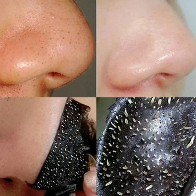 60g Blackhead Removing Nasal Mask Mild And Non Irritating To Shrink Pores And Remove Blackhead And Acne Tearing Facial Mask